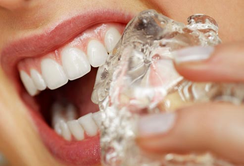 Επτά συνήθειες που βλάπτουν τα δόντια μας το καλοκαίρι