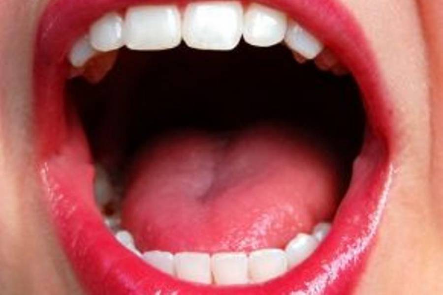 Ραγδαία αύξηση του καρκίνου του στόματος και του φάρυγγα 