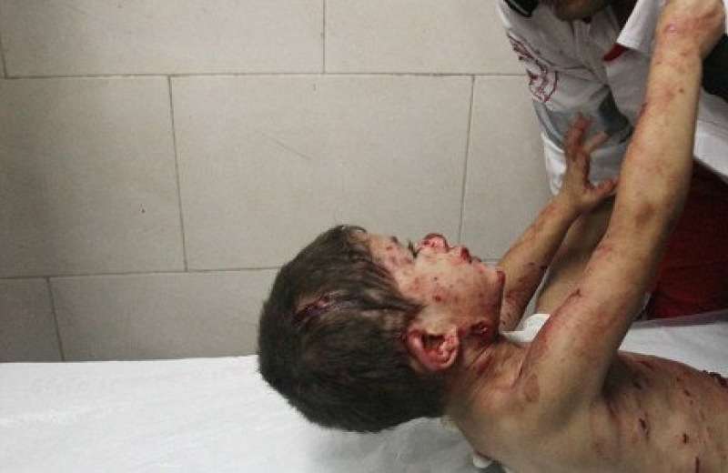 Σοκάρει η φωτογραφία του μικρού τραυματισμένου Παλαιστίνιου που ζητάει τον πατέρα του