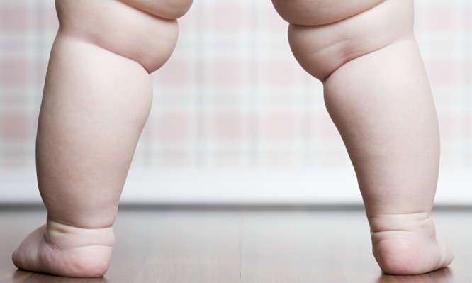Πώς φαίνεται από νωρίς αν το παιδί έχει ροπή προς την παχυσαρκία